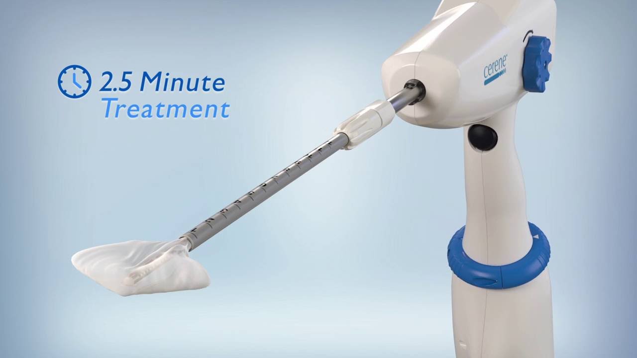 Cerene Cryotherapy, Membantu Mengatasi Pendarahan Berat Saat Menstruasi