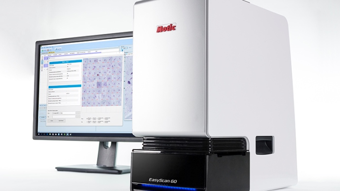 EasyScan GO, Mikroskop Pendeteksi Malaria Berteknologi AI